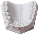 Whip-Mix-Ortho-Stone-15kg Sale