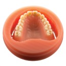 10-off-Polident-PMMA-Pink-Veined Sale