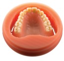 Polident-PMMA-CADCAM-Disc-Pink-Veined Sale