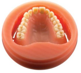 Polident-PMMA-CADCAM-Pink-Veined-Disc on sale