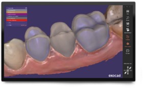 Exocad-Official-Reseller on sale