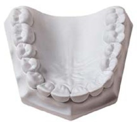 Whip+Mix+Ortho+Plaster+White+15kg