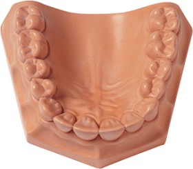 Whipmix-Snap-Stone-Pink-15kg on sale