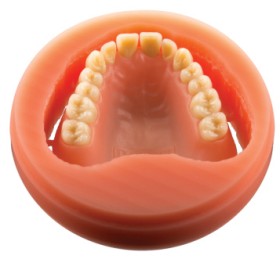 Polident-PMMA-CADCAM-Disc-Pink-Veined on sale